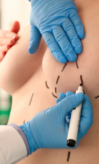 Informações Saiba mais sobre a Mamoplastia