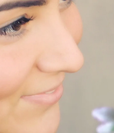 Dimpleplastia: tendência entre jovens, cirurgia plástica visa criar covinhas no rosto