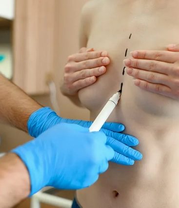 Aprovado direito a troca do implante mamário para pacientes de câncer 