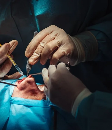 Como a rinoplastia pode auxiliar a saúde, além da estética