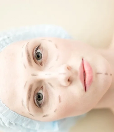 11 mitos e verdades sobre a rinoplastia