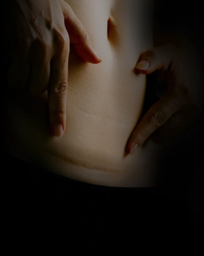 Cuidados com a Cicatrização