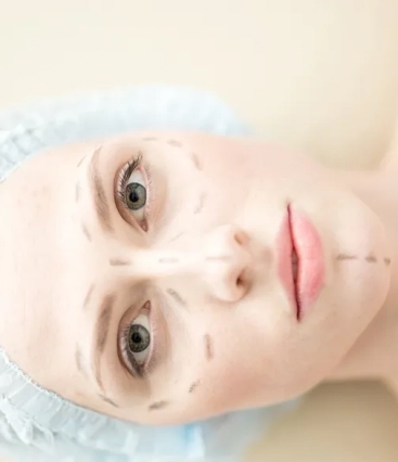 11 mitos e verdades sobre a rinoplastia