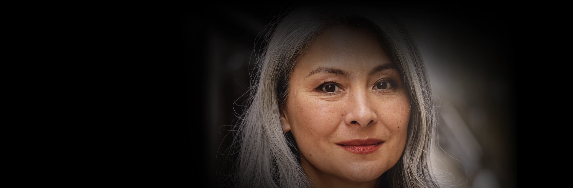 Procedimentos Cirurgia de Rejuvenescimento Facial (Ritidoplastia)