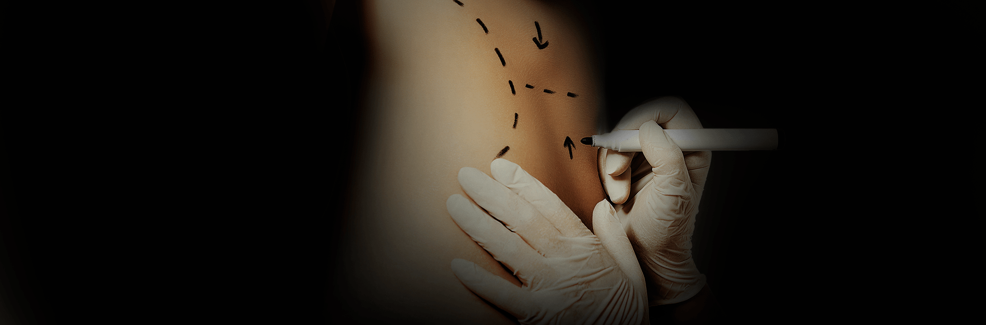 Procedimentos Mommy Makeover(Cirurgia Pós Gravidez) 