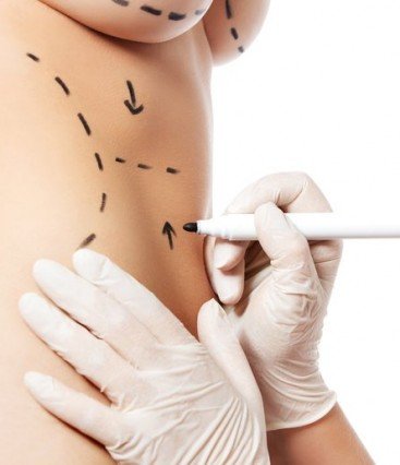 Quando Mommy Makeover é indicado?