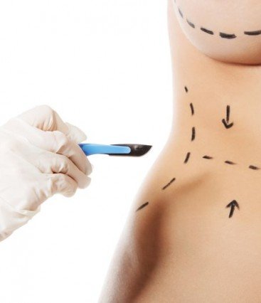 Quanto tempo leva para ver os resultados finais do Mommy Makeover?