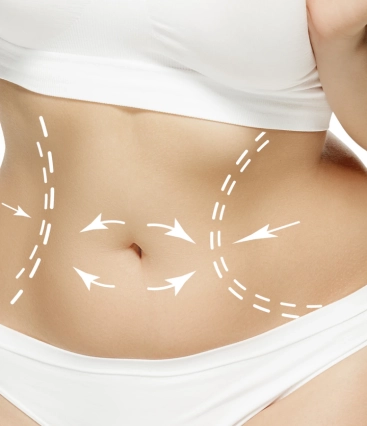 Mommy Makeover depois da gravidez: quando é o momento certo?