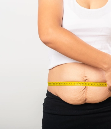 O  que é a abdominoplastia e como ela pode ajudar a melhorar a aparência do abdômen?