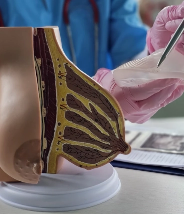 Cicatrização da mamoplastia redutora: qual o tempo para se formar