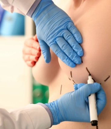 Silicone recuperação 24 horas valor