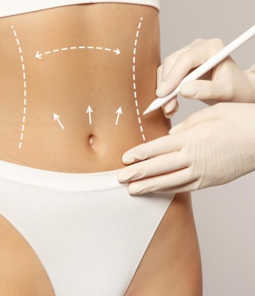 Cirurgia plástica com resultados naturais: o segredo por trás da harmonia estética