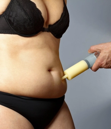 Como é a recuperação da lipoaspiração e da abdominoplastia? Cuidados essenciais no pós-operatório